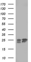 BID Antibody - HEK293T cells were transfected with the pCMV6-ENTRY control (Left lane) or pCMV6-ENTRY BID (Right lane) cDNA for 48 hrs and lysed. Equivalent amounts of cell lysates (5 ug per lane) were separated by SDS-PAGE and immunoblotted with anti-BID.