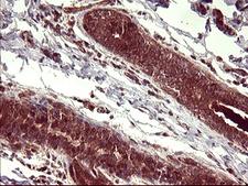 BID Antibody - IHC of paraffin-embedded Human breast tissue using anti-BID mouse monoclonal antibody. (Heat-induced epitope retrieval by 10mM citric buffer, pH6.0, 120°C for 3min).