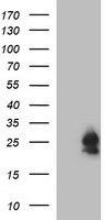 BID Antibody - HEK293T cells were transfected with the pCMV6-ENTRY control (Left lane) or pCMV6-ENTRY BID (Right lane) cDNA for 48 hrs and lysed. Equivalent amounts of cell lysates (5 ug per lane) were separated by SDS-PAGE and immunoblotted with anti-BID.