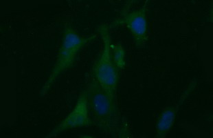BID Antibody - Immunofluorescent staining of HeLa cells using anti-BID mouse monoclonal antibody.