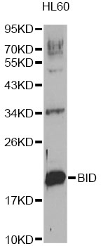 BID Antibody - Western blot analysis of extracts of HL-60 cells, using BID antibody. The secondary antibody used was an HRP Goat Anti-Rabbit IgG (H+L) at 1:10000 dilution. Lysates were loaded 25ug per lane and 3% nonfat dry milk in TBST was used for blocking. An ECL Kit was used for detection.