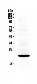 BID Antibody - Western blot analysis of Bcl-2 using anti-Bcl-2 antibody. Electrophoresis was performed on a 5-20% SDS-PAGE gel at 70V (Stacking gel) / 90V (Resolving gel) for 2-3 hours. The sample well of each lane was loaded with 50ug of sample under reducing conditions. Lane 1: mouse brain tissue lysate. After Electrophoresis, proteins were transferred to a Nitrocellulose membrane at 150mA for 50-90 minutes. Blocked the membrane with 5% Non-fat Milk/ TBS for 1.5 hour at RT. The membrane was incubated with rabbit anti-Bcl-2 antigen affinity purified polyclonal antibody at 0.5 µg/mL overnight at 4°C, then washed with TBS-0.1% Tween 3 times with 5 minutes each and probed with a goat anti-rabbit IgG-HRP secondary antibody at a dilution of 1:10000 for 1.5 hour at RT. The signal is developed using an Enhanced Chemiluminescent detection (ECL) kit with Tanon 5200 system. A specific band was detected for Bcl-2 at approximately 22KD. The expected band size for Bcl-2 is at 22KD.