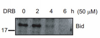 BID Antibody - Western blot analysis of BID p11 expression in OPM2 (A), OPM2 DRB-treated 2 hours (B), OPM2 DRB-treated 4 hours (C), OPM2 DRB-treated 6 hours (D) whole cell lysates.