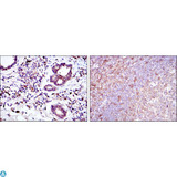 BID Antibody - Immunohistochemistry (IHC) analysis of paraffin-embedded prostate tissues (left) and tonsil tissues (right) with DAB staining using BID Monoclonal Antibody.