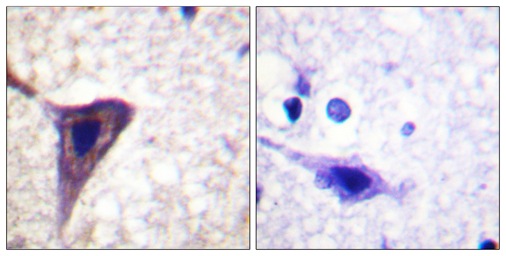 BID Antibody - Immunohistochemistry analysis of paraffin-embedded human brain, using BID (Phospho-Ser78) Antibody. The picture on the right is blocked with the phospho peptide.