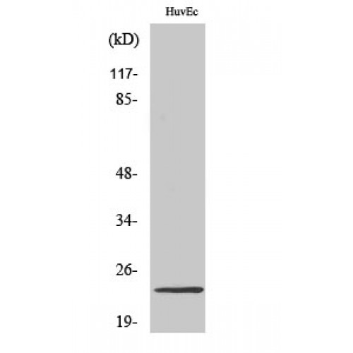 BIK Antibody - Western blot of NBK antibody