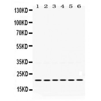 BIK Antibody - Bik antibody Western blot. All lanes: Anti Bik at 0.5 ug/ml. Lane 1: Rat Spleen Tissue Lysate at 50 ug. Lane 2: Rat Gaster Tissue Lysate at 50 ug. Lane 3: Rat Intestine Tissue Lysate at 50 ug. Lane 4: MCF-7 Whole Cell Lysate at 40 ug. Lane 5: A549 Whole Cell Lysate at 40 ug. Lane 6: SKOV Whole Cell Lysate at 40 ug. Predicted band size: 22 kD. Observed band size: 22 kD.