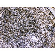 BIK Antibody - Bik antibody IHC-paraffin. IHC(P): Mouse Spleen Tissue.