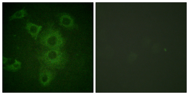 BIK Antibody - Immunofluorescence analysis of HUVEC cells, using BIK Antibody. The picture on the right is blocked with the synthesized peptide.