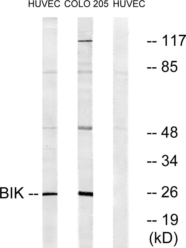 BIK Antibody - Western blot analysis of lysates from HUVEC/COLO205, using BIK Antibody. The lane on the right is blocked with the synthesized peptide.