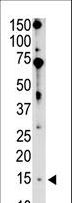 BIK Antibody - The anti-Bik BH3 domain antibody is used in Western blot to detect Bik BH3 in mouse brain tissue lysate.