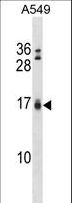 BIK Antibody - Bik Antibody (BH3) western blot of A549 cell line lysates (35 ug/lane). The Bik antibody detected the Bik protein (arrow).