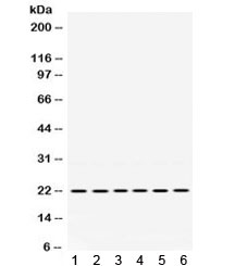 BIK Antibody