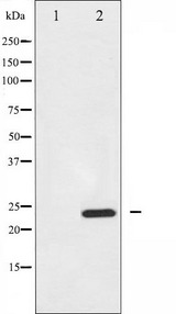 BIK Antibody - Western blot analysis of BIK expression in A549 whole cells lysates. The lane on the left is treated with the antigen-specific peptide.
