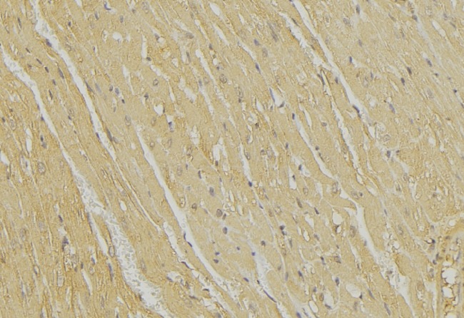 BIK Antibody - 1:100 staining mouse muscle tissue by IHC-P. The sample was formaldehyde fixed and a heat mediated antigen retrieval step in citrate buffer was performed. The sample was then blocked and incubated with the antibody for 1.5 hours at 22°C. An HRP conjugated goat anti-rabbit antibody was used as the secondary.