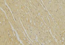 BIK Antibody - 1:100 staining mouse muscle tissue by IHC-P. The sample was formaldehyde fixed and a heat mediated antigen retrieval step in citrate buffer was performed. The sample was then blocked and incubated with the antibody for 1.5 hours at 22°C. An HRP conjugated goat anti-rabbit antibody was used as the secondary.