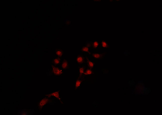 BIK Antibody - Staining HepG2 cells by IF/ICC. The samples were fixed with PFA and permeabilized in 0.1% Triton X-100, then blocked in 10% serum for 45 min at 25°C. The primary antibody was diluted at 1:200 and incubated with the sample for 1 hour at 37°C. An Alexa Fluor 594 conjugated goat anti-rabbit IgG (H+L) Ab, diluted at 1/600, was used as the secondary antibody.