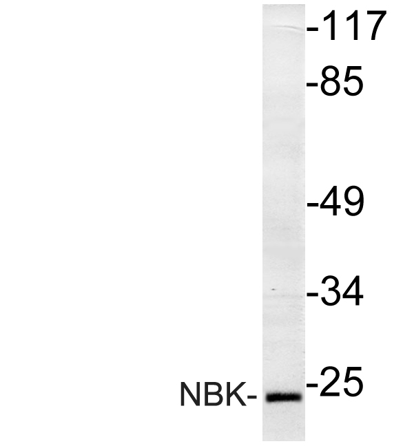 BIK Antibody - Western blot of BIK (M27) pAb in extracts from A549 cell treated with DMSO 0.1% 10' cells.