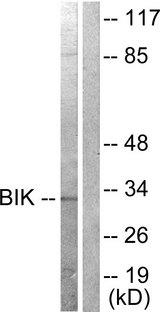 BIK Antibody - Western blot analysis of extracts from A549 cells, treated with DMSO (0.1%, 10mins), using BIK (Ab-33) antibody ( Line 1 and 2).