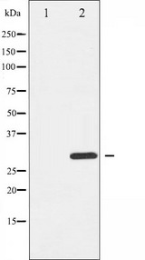 BIK Antibody - Western blot analysis of BIK phosphorylation expression in HepG2 whole cells lysates. The lane on the left is treated with the antigen-specific peptide.