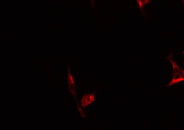 BIK Antibody - Staining HepG2 cells by IF/ICC. The samples were fixed with PFA and permeabilized in 0.1% Triton X-100, then blocked in 10% serum for 45 min at 25°C. The primary antibody was diluted at 1:200 and incubated with the sample for 1 hour at 37°C. An Alexa Fluor 594 conjugated goat anti-rabbit IgG (H+L) Ab, diluted at 1/600, was used as the secondary antibody.