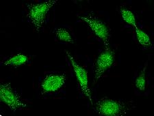 BIK Antibody - Immunofluorescence staining of BIK in HeLa cells. Cells were fixed with 4% PFA, permeabilzed with 0.3% Triton X-100 in PBS, blocked with 10% serum, and incubated with rabbit anti-human BIK polyclonal antibody (dilution ratio: 1:1000) at 4°C overnight. Then cells were stained with the Alexa Fluor 488-conjugated Goat Anti-rabbit IgG secondary antibody (green). Positive staining was localized to cytoplasm and nucleus.