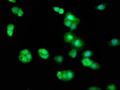 BIN2 Antibody - Immunofluorescence staining of HepG2 cells at a dilution of 1:33, counter-stained with DAPI. The cells were fixed in 4% formaldehyde, permeabilized using 0.2% Triton X-100 and blocked in 10% normal Goat Serum. The cells were then incubated with the antibody overnight at 4 °C.The secondary antibody was Alexa Fluor 488-congugated AffiniPure Goat Anti-Rabbit IgG (H+L) .