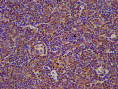 BIN2 Antibody - IHC image of BIN2 Antibody diluted at 1:100 and staining in paraffin-embedded human lymph node tissue performed on a Leica BondTM system. After dewaxing and hydration, antigen retrieval was mediated by high pressure in a citrate buffer (pH 6.0). Section was blocked with 10% normal goat serum 30min at RT. Then primary antibody (1% BSA) was incubated at 4°C overnight. The primary is detected by a biotinylated secondary antibody and visualized using an HRP conjugated SP system.