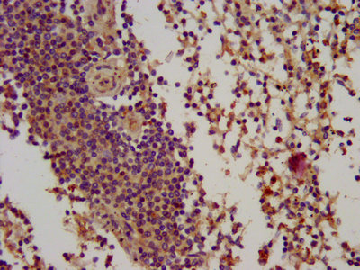 BIN2 Antibody - IHC image of BIN2 Antibody diluted at 1:100 and staining in paraffin-embedded human spleen tissue performed on a Leica BondTM system. After dewaxing and hydration, antigen retrieval was mediated by high pressure in a citrate buffer (pH 6.0). Section was blocked with 10% normal goat serum 30min at RT. Then primary antibody (1% BSA) was incubated at 4°C overnight. The primary is detected by a biotinylated secondary antibody and visualized using an HRP conjugated SP system.