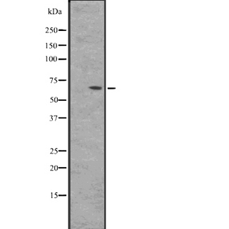 BIN2 Antibody - Western blot analysis of BIN2 expression in HepG2 whole cells lysate. The lane on the left is treated with the antigen-specific peptide.