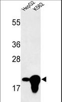 BIN3 Antibody - Western blot of BIN3 Antibody in HepG2, K562 cell line lysates (35 ug/lane). BIN3 (arrow) was detected using the purified antibody.