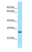 BIN3 Antibody - BIN3 antibody Western Blot of Fetal Liver.  This image was taken for the unconjugated form of this product. Other forms have not been tested.