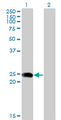 BIN3 Antibody - Western blot of BIN3 expression in transfected 293T cell line by BIN3 monoclonal antibody (M02), clone 1H8.