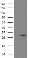 BIN3 Antibody - HEK293T cells were transfected with the pCMV6-ENTRY control (Left lane) or pCMV6-ENTRY BIN3 (Right lane) cDNA for 48 hrs and lysed. Equivalent amounts of cell lysates (5 ug per lane) were separated by SDS-PAGE and immunoblotted with anti-BIN3.