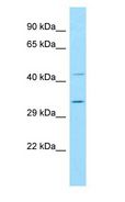 BIN3 Antibody - BIN3 antibody Western Blot of THP-1 cell lysate.  This image was taken for the unconjugated form of this product. Other forms have not been tested.