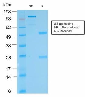 Biotin Antibody - SDS-PAGE Analysis Purified anti-biotin Rabbit Recombinant Monoclonal antibody (BTN/2032R). Confirmation of Purity and Integrity of Antibody.