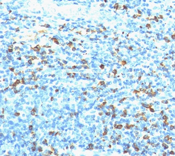 Biotin Antibody - Biotin lambda antibody Hyb-8 immunohistochemistry tonsil This image was taken for the unmodified form of this product. Other forms have not been tested.