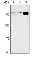 BIRC1 / NAIP Antibody - Western blot analysis of NAIP expression in HEK293T (A), SGC7901 (B), Raw264.7 (C) whole cell lysates.