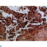 BIRC1 / NAIP Antibody - Immunohistochemical analysis of paraffin-embedded human-placenta, antibody was diluted at 1:100.