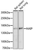 BIRC1 / NAIP Antibody - Western blot analysis of extracts of various cell lines using NAIP Polyclonal Antibody at dilution of 1:1000.