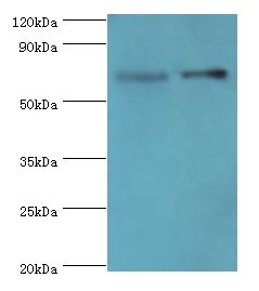 BIRC2 / cIAP1 Antibody - Western blot. All lanes: Baculoviral IAP repeat-containing protein 2 antibody at 5 ug/ml <br/>Lane 1: HepG2 whole cell lysate <br/>Lane 2: K562 whole cell lysate <br/>secondary <br/>Goat polyclonal to rabbit at 1:10000 dilution <br/>Predicted band size: 70 kDa <br/>Observed band size: 70 kDa.