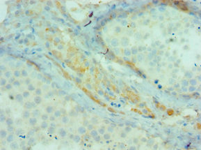 BIRC2 / cIAP1 Antibody - Immunohistochemistry of paraffin-embedded human testis tissue using BIRC2 Antibody at dilution of 1:100