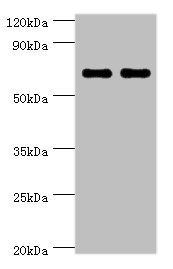 BIRC2 / cIAP1 Antibody - Western blot All lanes: BIRC2 antibody at 5µg/ml Lane 1: HepG2 whole cell lysate Lane 2: K562 whole cell lysate Secondary Goat polyclonal to rabbit IgG at 1/10000 dilution Predicted band size: 70, 65 kDa Observed band size: 70 kDa