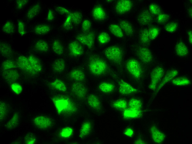 BIRC2 / cIAP1 Antibody - Immunofluorescence analysis of A549 cells using BIRC2 antibody.