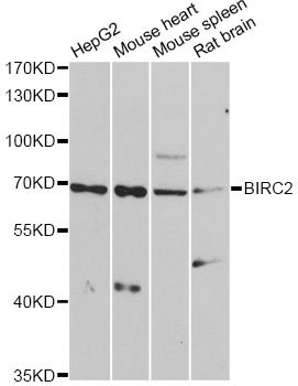 BIRC2 / cIAP1 Antibody - Western blot analysis of extracts of various cell lines, using BIRC2 antibody at 1:1000 dilution. The secondary antibody used was an HRP Goat Anti-Rabbit IgG (H+L) at 1:10000 dilution. Lysates were loaded 25ug per lane and 3% nonfat dry milk in TBST was used for blocking. An ECL Kit was used for detection and the exposure time was 90s.