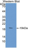 BIRC2 / cIAP1 Antibody - Western blot of recombinant BIRC2 / cIAP1.  This image was taken for the unconjugated form of this product. Other forms have not been tested.