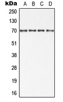 BIRC2 / cIAP1 Antibody - Western blot analysis of cIAP1 expression in HT29 (A); Jurkat (B); SP2/0 (C); PC12 (D) whole cell lysates.
