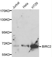 BIRC2 / cIAP1 Antibody - Western blot of BIRC2 pAb in extracts from Jurkat, Hela and HT29 cells.
