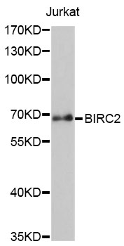 BIRC2 / cIAP1 Antibody - Western blot analysis of extracts of Jurkat cells, using BIRC2 antibody at 1:1000 dilution. The secondary antibody used was an HRP Goat Anti-Rabbit IgG (H+L) at 1:10000 dilution. Lysates were loaded 25ug per lane and 3% nonfat dry milk in TBST was used for blocking. An ECL Kit was used for detection and the exposure time was 90s.