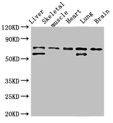 BIRC2 / cIAP1 Antibody - Western Blot Positive WB detected in:Rat liver tissue,Rat skeletal muscle tissue,Mouse heart tissue,Mouse lung tissue,Mouse brain tissue All Lanes:BIRC2 antibody at 3.5µg/ml Secondary Goat polyclonal to rabbit IgG at 1/50000 dilution Predicted band size: 70,65 KDa Observed band size: 70,65 KDa
